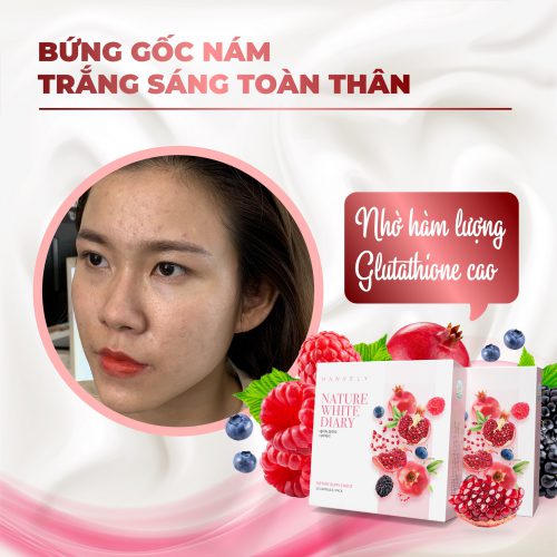 Viên uống Hanvely Hàn Quốc trị nám trắng da đáng tin dùng hay không? Vien uong Hanvely tri nam the he moi 500x500 - Viên uống Hanvely Hàn Quốc trị nám trắng da đáng tin dùng hay không?